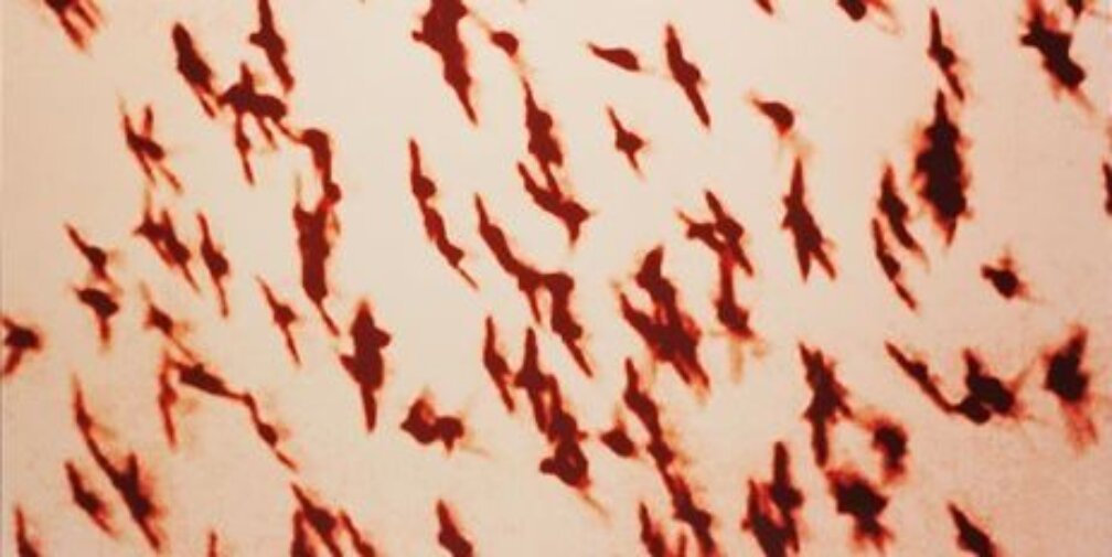 Michal Rovner at South London Synagogue | Zabludowicz Collection | Loans